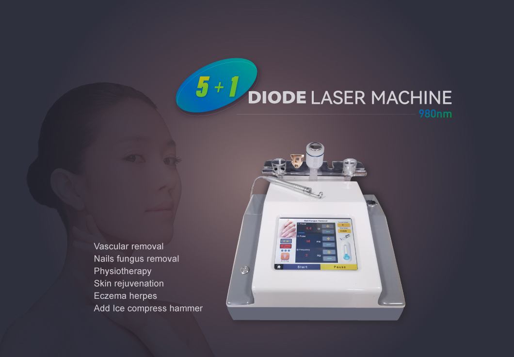 980 nm vascular removal diode laser